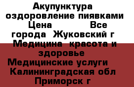 Акупунктура, оздоровление пиявками › Цена ­ 3 000 - Все города, Жуковский г. Медицина, красота и здоровье » Медицинские услуги   . Калининградская обл.,Приморск г.